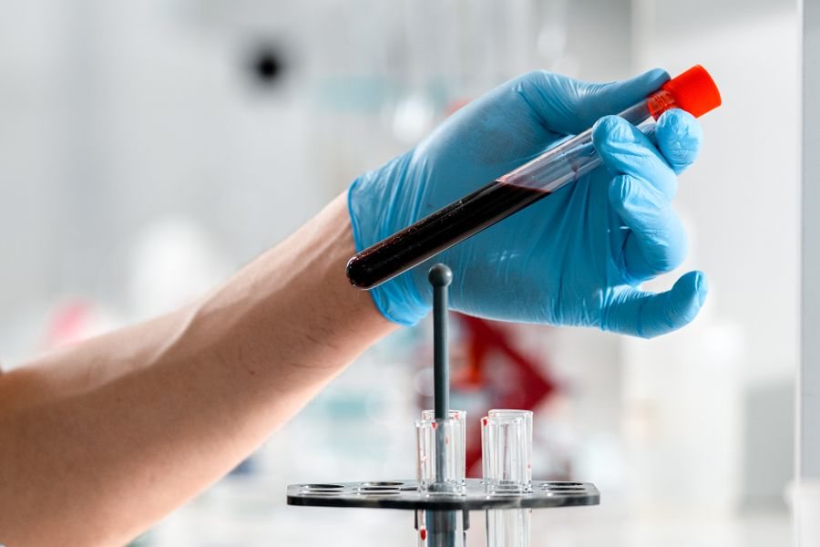 Blood sample tube in our laboratory